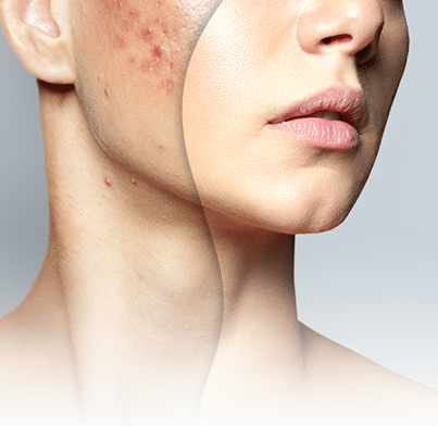 Research Collaboration Images - Anti-Scarring - AOR